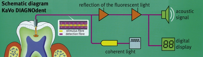 Schematic diagram KaVo DIAGNOdent