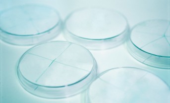 Partikelzähler für Flüssigkeiten