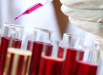 Particle measuring systems for oils